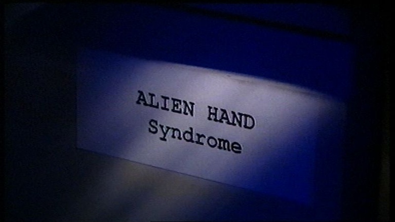 image for Alien Hand Syndrome