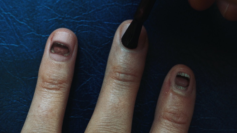 image for Fingernails